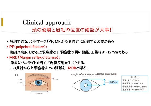 Clinical approach
• 解剖学的なランドマーク（PF，MRD）を具体的に記録する必要がある
• PF（palpebral fissure）：
瞳孔の軸における上眼瞼縁と下眼瞼縁の間の距離．正常は9～12mmである
• MRD（Margin reflex distanse）：
患者にペンライトを当てて角膜反射を生じさせる．
この反射から上眼瞼縁までの距離を， MRDと呼ぶ．
頭の姿勢と眉毛の位置の確認が大事！！
PF
