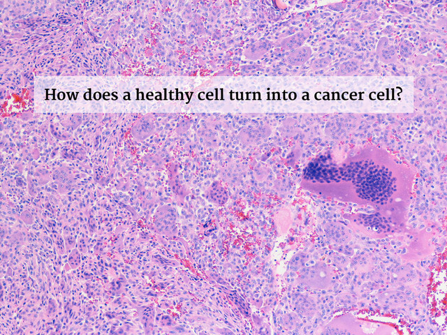 How does a healthy cell turn into a cancer cell?
