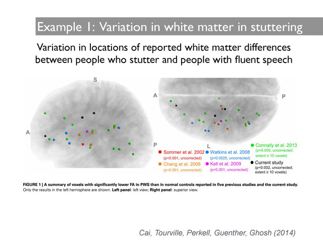 Example 1: Variation in white matter in stuttering
Cai, Tourville, Perkell, Guenther, Ghosh (2014)
Variation in locations of reported white matter differences 	

between people who stutter and people with ﬂuent speech
