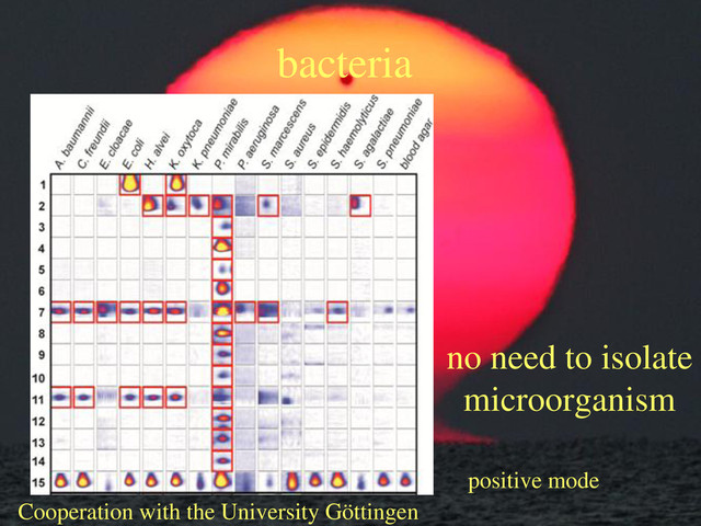 bacteria
positive mode
Cooperation with the University Göttingen
no need to isolate
microorganism
