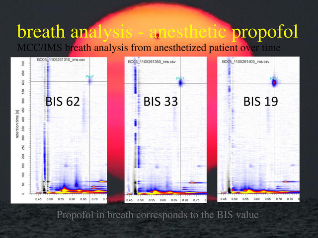 MCC/IMS breath analysis from anesthetized patient over time
BIS 19
BIS 33
BIS 62
Propofol in breath corresponds to the BIS value
breath analysis - anesthetic propofol
