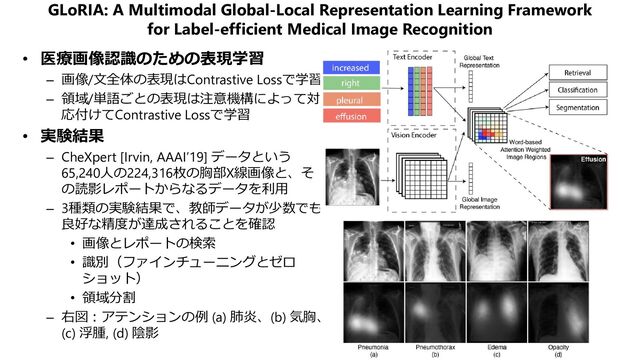 GLoRIA: A Multimodal Global-Local Representation Learning Framework
for Label-efficient Medical Image Recognition
• 医療画像認識のための表現学習
– 画像/文全体の表現はContrastive Lossで学習
– 領域/単語ごとの表現は注意機構によって対
応付けてContrastive Lossで学習
• 実験結果
– CheXpert [Irvin, AAAI’19] データという
65,240人の224,316枚の胸部X線画像と、そ
の読影レポートからなるデータを利用
– 3種類の実験結果で、教師データが少数でも
良好な精度が達成されることを確認
• 画像とレポートの検索
• 識別（ファインチューニングとゼロ
ショット）
• 領域分割
– 右図：アテンションの例 (a) 肺炎、(b) 気胸、
(c) 浮腫, (d) 陰影
