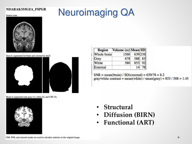 Neuroimaging QA
• Structural
• Diffusion (BIRN)
• Functional (ART)
