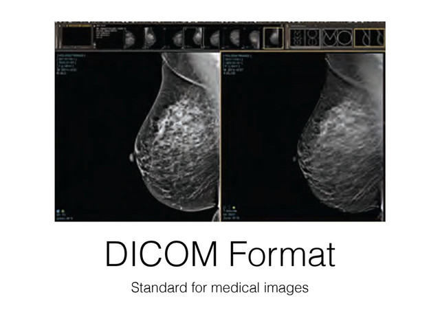 DICOM Format
Standard for medical images
