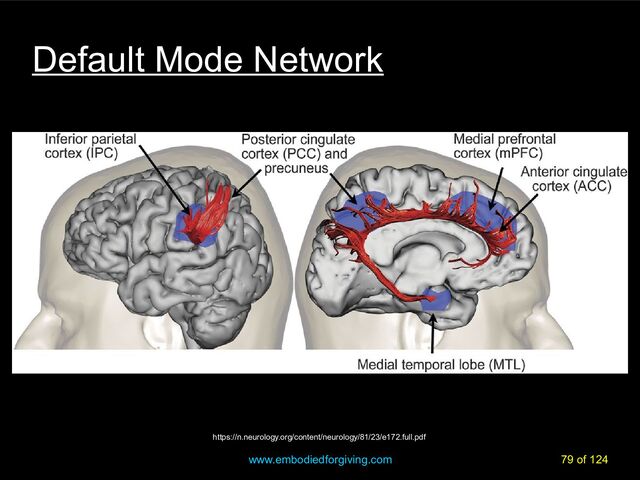 www.embodiedforgiving.com 79 of 124
https://n.neurology.org/content/neurology/81/23/e172.full.pdf
Default Mode Network
