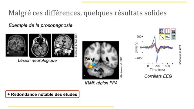 Malgré ces différences, quelques résultats solides
Lésion neurologique
Exemple de la prosopagnosie
IRMf: région FFA
Corrélats EEG
+ Redondance notable des études
Ghuman et al., 2014
Kleinhans et al., 2015
Behrmann & Plaut, 2014
