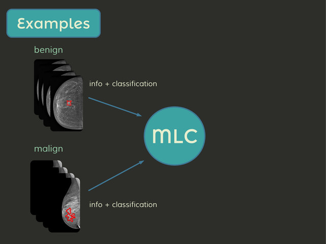 benign
malign
Examples
MLC
info + classification
info + classification

