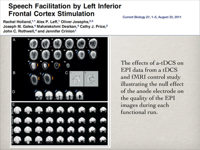The effects of a-tDCS on
EPI data from a tDCS
and fMRI control study
illustrating the null effect
of the anode electrode on
the quality of the EPI
images during each
functional run.
