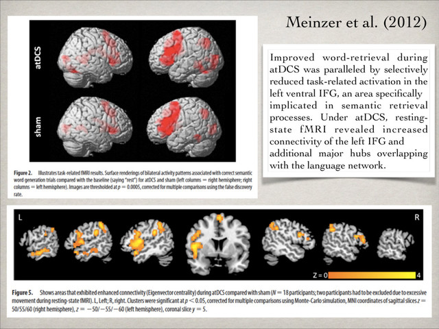 Improved word-retrieval during
atDCS was paralleled by selectively
reduced task-related activation in the
left ventral IFG, an area speciﬁcally	

implicated in semantic retrieval
processes. Under atDCS, resting-
state fMRI revealed increased
connectivity of the left IFG and	

additional major hubs overlapping
with the language network.
Meinzer et al. (2012)
