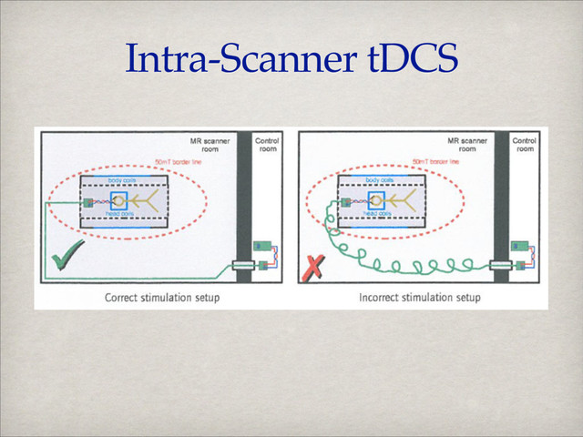 Intra-Scanner tDCS
