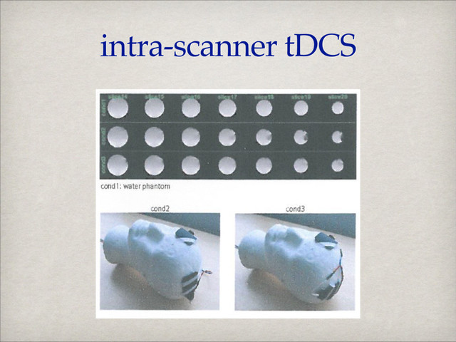 intra-scanner tDCS
