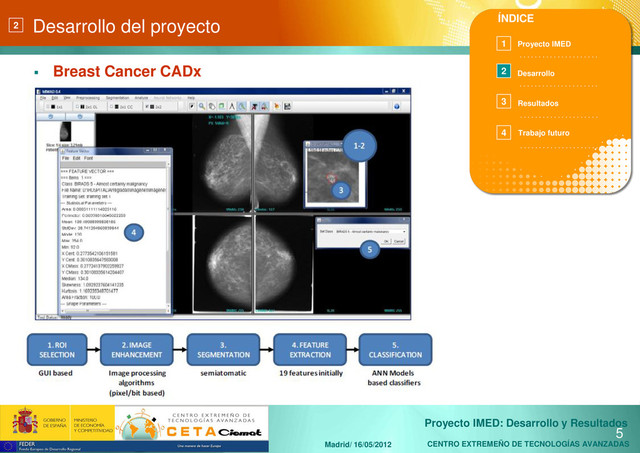 CENTRO EXTREMEÑO DE TECNOLOGÍAS AVANZADAS
Proyecto IMED: Desarrollo y Resultados
Madrid/ 16/05/2012
Desarrollo del proyecto
 Breast Cancer CADx
5
2
. . . . . . . . . . . . . . . . . . . . .
. . . . . . . . . . . . . . . . . . . . .
. . . . . . . . . . . . . . . . . . . . .
. . . . . . . . . . . . . . . . . . . . .
ÍNDICE
Proyecto IMED
Desarrollo
Resultados
1
2
3
4 Trabajo futuro
