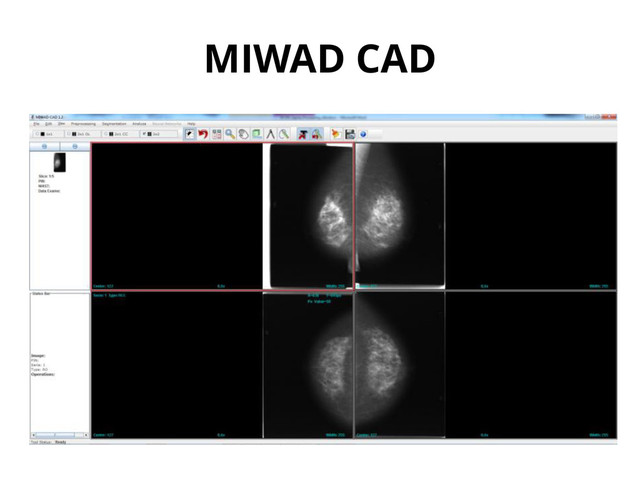 MIWAD CAD
