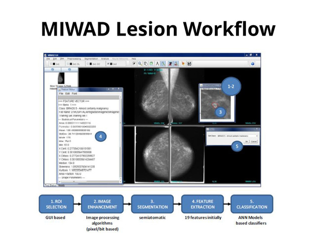 MIWAD Lesion Workflow
