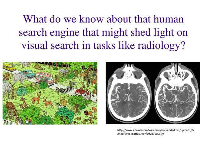 What do we know about that human
search engine that might shed light on
visual search in tasks like radiology?
http://www.adcmri.com/welcome/backendadmin/uploads/8c
24bdf59cb8b4ffa97cc7f592b39c51.gif
