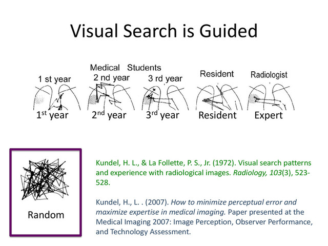 Visual Search is Guided
1st year 2nd year 3rd year Resident Expert
Kundel, H. L., & La Follette, P. S., Jr. (1972). Visual search patterns
and experience with radiological images. Radiology, 103(3), 523-
528.
Kundel, H., L. . (2007). How to minimize perceptual error and
maximize expertise in medical imaging. Paper presented at the
Medical Imaging 2007: Image Perception, Observer Performance,
and Technology Assessment.
Random
