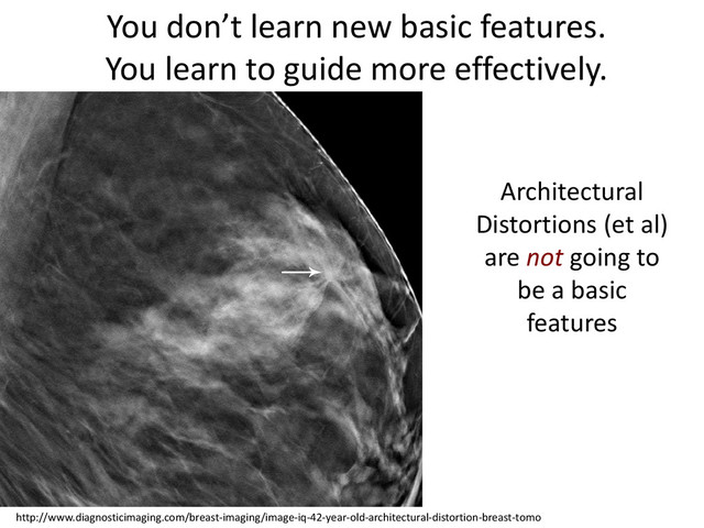 http://www.diagnosticimaging.com/breast-imaging/image-iq-42-year-old-architectural-distortion-breast-tomo
You don’t learn new basic features.
You learn to guide more effectively.
Architectural
Distortions (et al)
are not going to
be a basic
features

