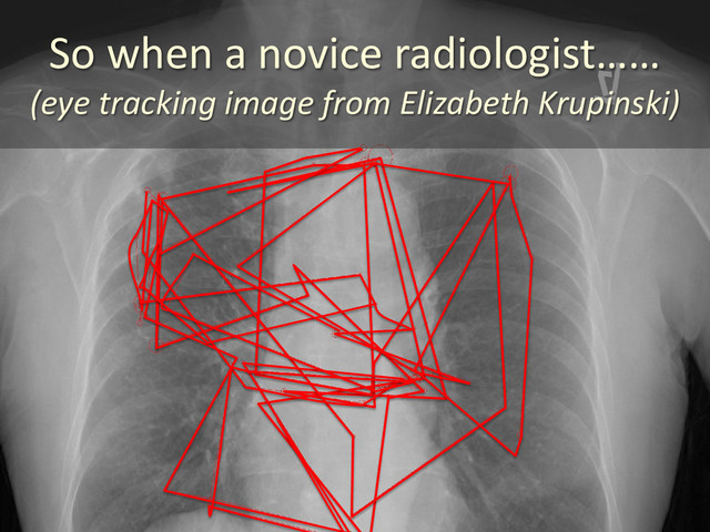 So when a novice radiologist……
(eye tracking image from Elizabeth Krupinski)
