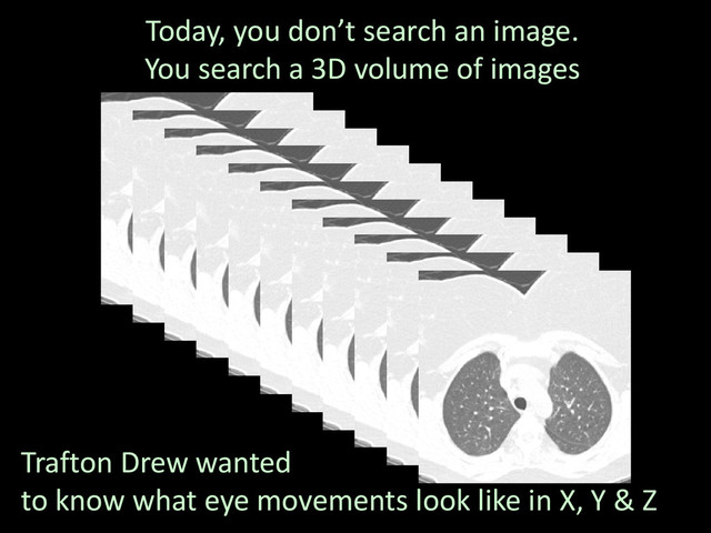 Today, you don’t search an image.
You search a 3D volume of images
Trafton Drew wanted
to know what eye movements look like in X, Y & Z
