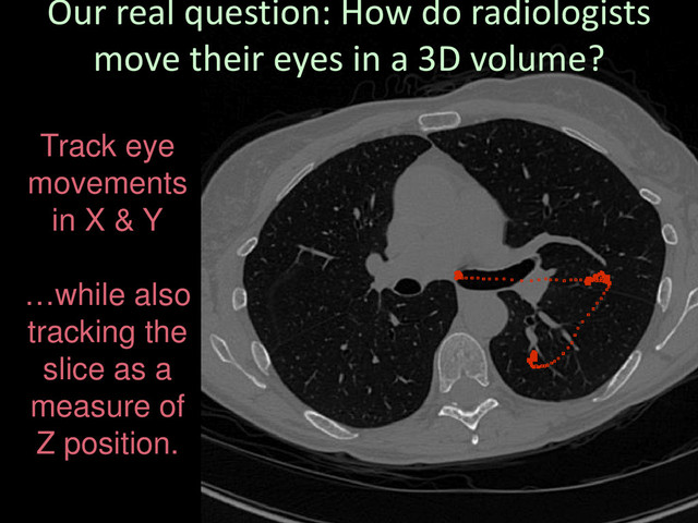 Track eye
movements
in X & Y
…while also
tracking the
slice as a
measure of
Z position.
Our real question: How do radiologists
move their eyes in a 3D volume?
