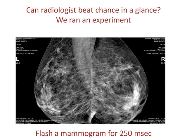 Can radiologist beat chance in a glance?
We ran an experiment
Look here
Flash a mammogram for 250 msec
