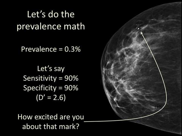 CC views
Right Left
Let’s do the
prevalence math
Prevalence = 0.3%
Let’s say
Sensitivity = 90%
Specificity = 90%
(D’ = 2.6)
How excited are you
about that mark?
