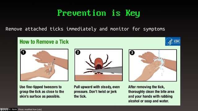 Prevention is Key
Remove attached ticks immediately and monitor for symptoms
Photo: modified from [cdc]
