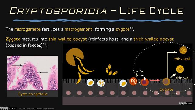 The microgamete fertilizes a macrogamont, forming a zygote11.
Zygote matures into thin-walled oocyst (reinfects host) and a thick-walled oocyst
(passed in faeces)11.
Photo: healthtian.com/cryptosporidiosis
Cryptosporidia — Life Cycle
zygote
thick wall
thin wall
Cysts on epithelia
