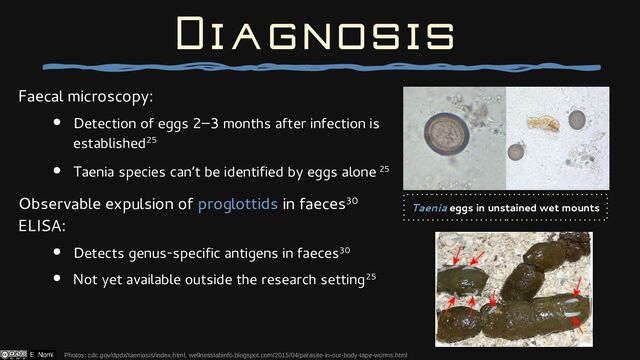 Faecal microscopy:
● Detection of eggs 2–3 months after infection is
established25
● Taenia species can’t be identified by eggs alone 25
Observable expulsion of proglottids in faeces30
ELISA:
● Detects genus-specific antigens in faeces30
● Not yet available outside the research setting25
Photos: cdc.gov/dpdx/taeniasis/index.html, wellnesslabinfo.blogspot.com/2015/04/parasite-in-our-body-tape-worms.html
Diagnosis
Taenia eggs in unstained wet mounts
