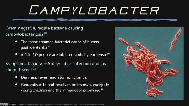 Gram-negative, motile bacteria causing
campylobacteriosis38
● The most common bacterial cause of human
gastroenteritis39
● ≈ 1 in 10 people are infected globally each year39
Symptoms begin 2 – 5 days after infection and last
about 1 week38
● Diarrhea, fever, and stomach cramps
● Generally mild and resolves on its own, except in
young children and the immunocompromised39
Photo: "Campylobacter Jejuni Bacteria" © Steve Gschmeissner, July 1, 2016, on fineartamerica.com
Campylobacter
