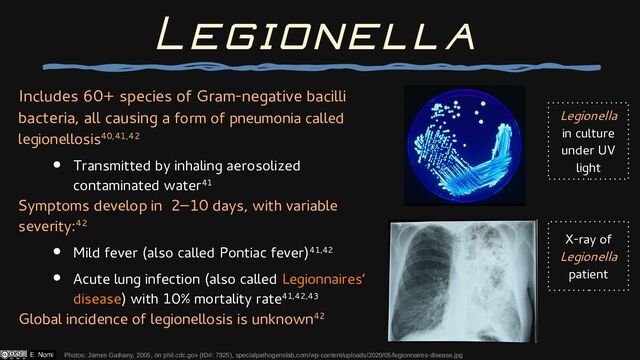Includes 60+ species of Gram-negative bacilli
bacteria, all causing a form of pneumonia called
legionellosis40,41,42
● Transmitted by inhaling aerosolized
contaminated water41
Symptoms develop in 2–10 days, with variable
severity:42
● Mild fever (also called Pontiac fever)41,42
● Acute lung infection (also called Legionnaires’
disease) with 10% mortality rate41,42,43
Global incidence of legionellosis is unknown42
Photos: James Gathany, 2005, on phil.cdc.gov (ID#: 7925), specialpathogenslab.com/wp-content/uploads/2020/05/legionnaires-disease.jpg
Legionella
X-ray of
Legionella
patient
Legionella
in culture
under UV
light
