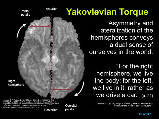 www.neuroanthropologist.com
www.neuroanthropologist.com 56 of 107
Yakovlevian Torque
Yakovlevian Torque
Oliveira, E. P., Feitosa, E., SANTOS, G., SILVA, E., PINCERATO, R., &
PORTELA, L. (2016, March 2). Left Brain, Right Brain: Cerebral Asymmetry
Beyond the Handedness. An Anatomic Review on Brain Laterality [Text]. ECR
2016 EPOS; European Congress of Radiology - ECR 2016.
https://epos.myesr.org/poster/esr/ecr2016/C-1559
Asymmetry and
lateralization of the
hemispheres conveys
a dual sense of
ourselves in the world.
“For the right
hemisphere, we live
the body; for the left,
we live in it, rather as
we drive a car.” (p. 21)
McGilchrist, I. (2018). Ways of Attending: How our Divided Brain
Constructs the World (1 edition). Routledge.
