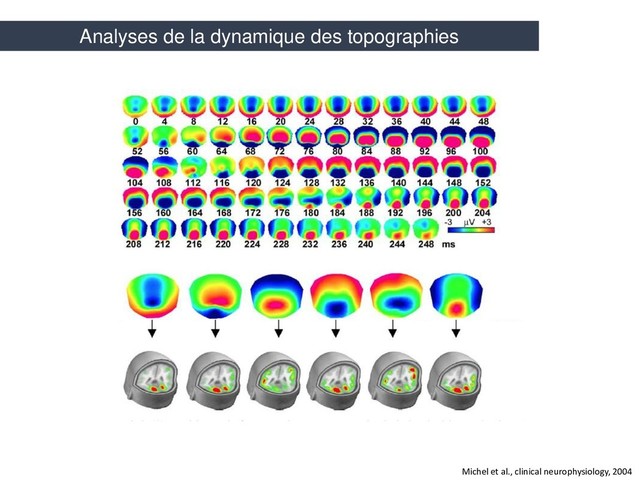 Michel et al., clinical neurophysiology, 2004
Analyses de la dynamique des topographies
