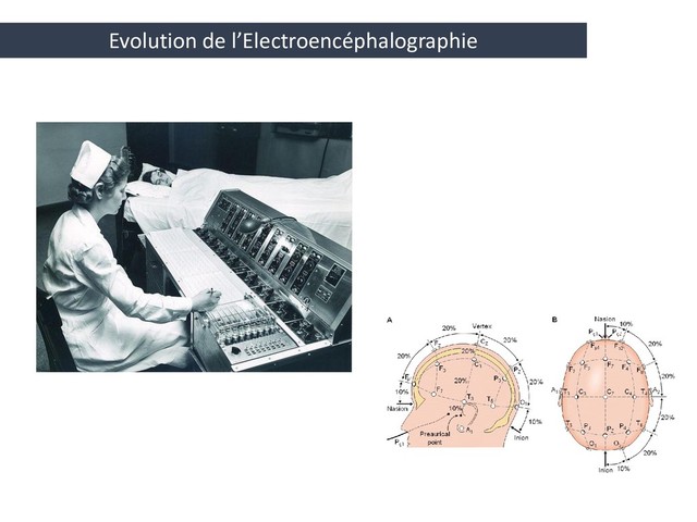 Evolution de l’Electroencéphalographie
