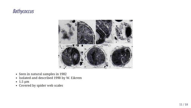 Bathycoccus
Seen in natural samples in 1982
Isolated and described 1990 by W. Eikrem
1.5 µm
Covered by spider web scales
11 / 18
