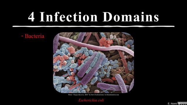 E. Nomi
4 Infection Domains
- Bacteria
Photo: “Tongue Bacteria, SEM” by Steve Gschmeissner, via fineartamerica.com
Escherichia coli

