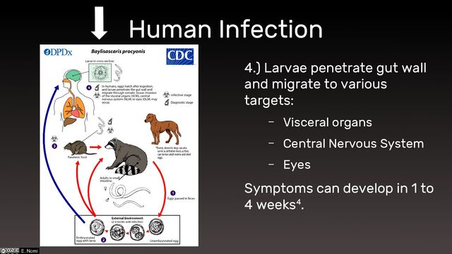 Human Infection
4.) Larvae penetrate gut wall
and migrate to various
targets:
– Visceral organs
– Central Nervous System
– Eyes
Symptoms can develop in 1 to
4 weeks4.
