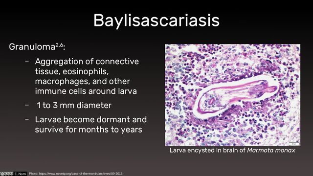 Baylisascariasis
Granuloma2,6:
– Aggregation of connective
tissue, eosinophils,
macrophages, and other
immune cells around larva
– 1 to 3 mm diameter
– Larvae become dormant and
survive for months to years
Larva encysted in brain of Marmota monax
Photo: https://www.ncvetp.org/case-of-the-month/archives/09-2018
