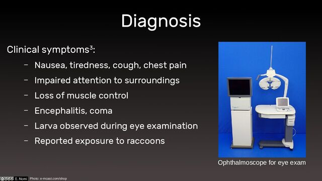 Diagnosis
Clinical symptoms3:
– Nausea, tiredness, cough, chest pain
– Impaired attention to surroundings
– Loss of muscle control
– Encephalitis, coma
– Larva observed during eye examination
– Reported exposure to raccoons
Ophthalmoscope for eye exam
Photo: e-mcast.com/shop

