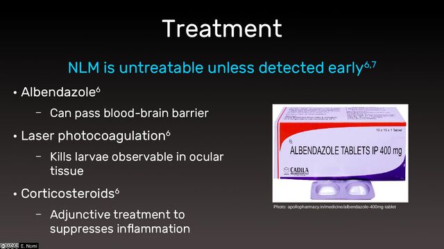 Treatment
• Albendazole6
– Can pass blood-brain barrier
• Laser photocoagulation6
– Kills larvae observable in ocular
tissue
• Corticosteroids6
– Adjunctive treatment to
suppresses inflammation
NLM is untreatable unless detected early6,7
Photo: apollopharmacy.in/medicine/albendazole-400mg-tablet
