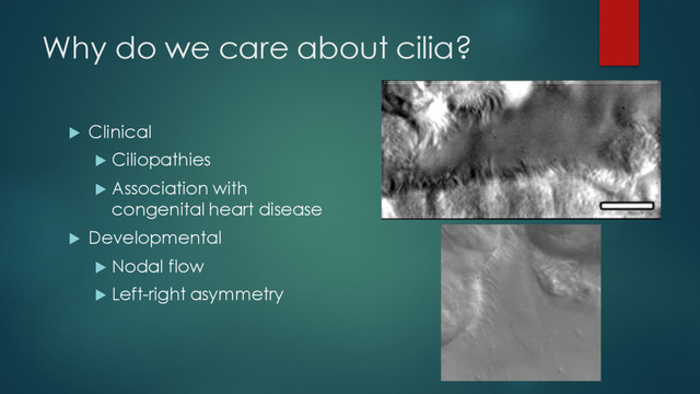 Why do we care about cilia?
u Clinical
u Ciliopathies
u Association with
congenital heart disease
u Developmental
u Nodal flow
u Left-right asymmetry

