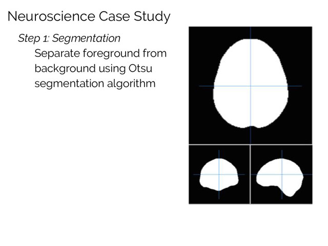 Neuroscience Case Study
Step 1: Segmentation
Separate foreground from
background using Otsu
segmentation algorithm
