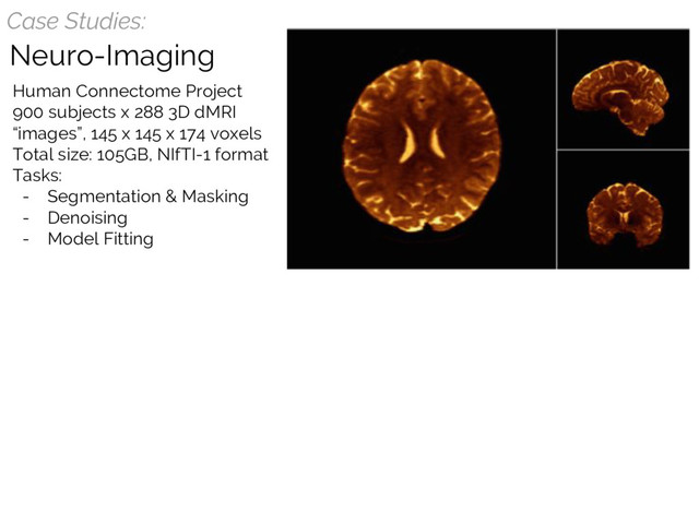 Case Studies:
Neuro-Imaging
Human Connectome Project
900 subjects x 288 3D dMRI
“images”, 145 x 145 x 174 voxels
Total size: 105GB, NIfTI-1 format
Tasks:
- Segmentation & Masking
- Denoising
- Model Fitting
