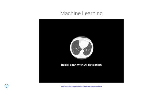 Machine Learning
https://www.blog.google/technology/health/lung-cancer-prediction/
