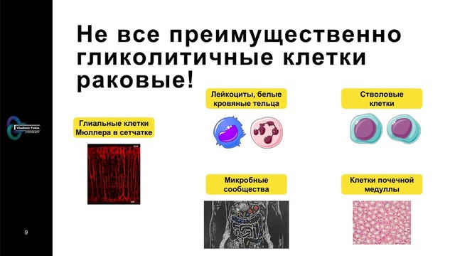 9
Не все преимущественно
гликолитичные клетки
раковые!
Глиальные клетки
Мюллера в сетчатке
Лейкоциты, белые
кровяные тельца
Стволовые
клетки
Клетки почечной
медуллы
Микробные
сообщества
