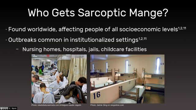 Who Gets Sarcoptic Mange?
∙ Found worldwide, affecting people of all socioeconomic levels1,2,11
∙ Outbreaks common in institutionalized settings1,2,11
– Nursing homes, hospitals, jails, childcare facilities
Photo: Jaimie Ding on oregonlive.com
Photo: sitedebelezaemoda.com.br/seguro-saude-viagem
