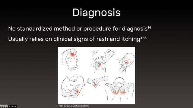 Diagnosis
∙ No standardized method or procedure for diagnosis14
∙ Usually relies on clinical signs of rash and itching4,15
Photo: std-gov.org/stds/scabies.htm

