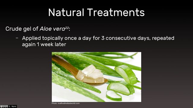 Natural Treatments
Photo: realfoodinafastworld.com
Crude gel of Aloe vera22:
– Applied topically once a day for 3 consecutive days, repeated
again 1 week later
