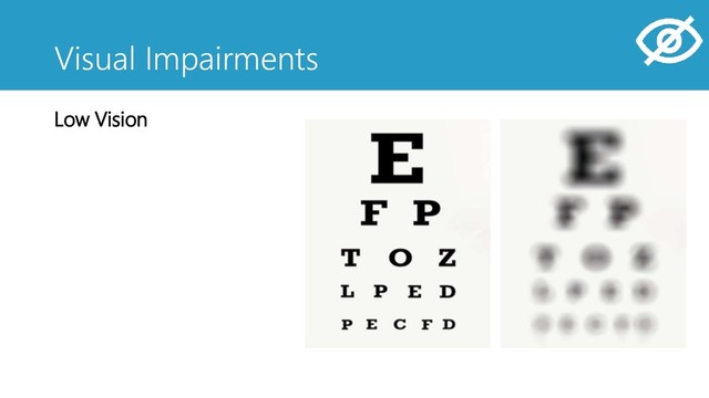 Visual Impairments
Low Vision
