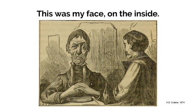 This was my face, on the inside.
A.D. Crabtre, 1874
